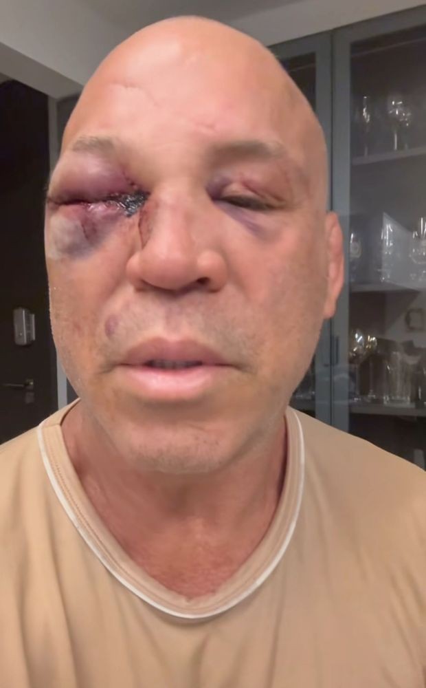 Matt Brown đưa ra lời khuyên cho các võ sĩ.