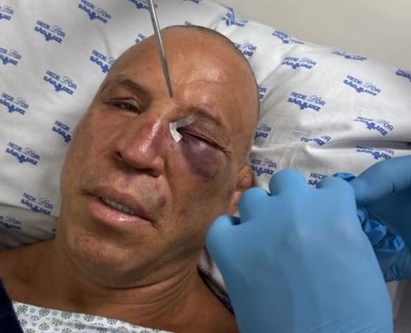 Wanderlei Silva’s post-fight attacker identified as opponent’s son, fighters react to wild knockout