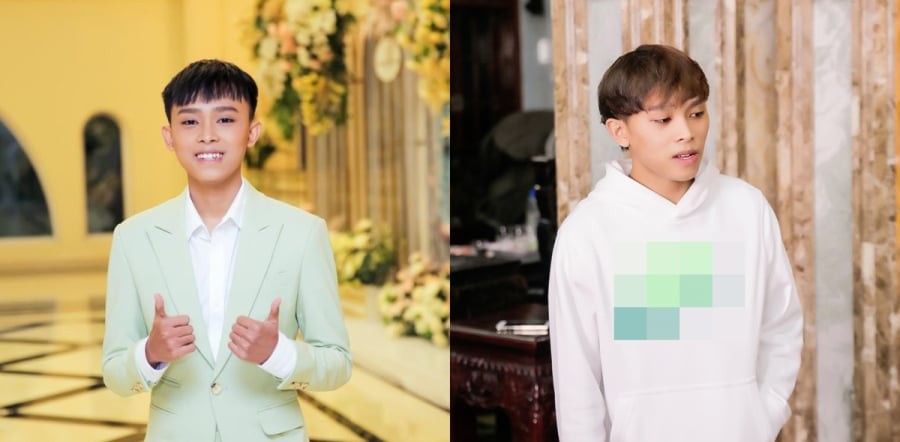 Hồ Văn Cường nói gì khi được hỏi về việc có ý định phẫu thuật thẩm mỹ không?