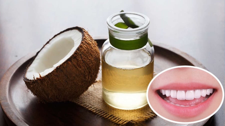 Súc miệng dầu dừa giúp giảm lượng vi khuẩn trong khoang miệng.