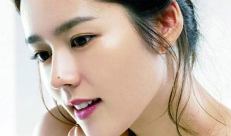 Nốt ruồi may mắn trên mặt của bạn đừng xóa đi