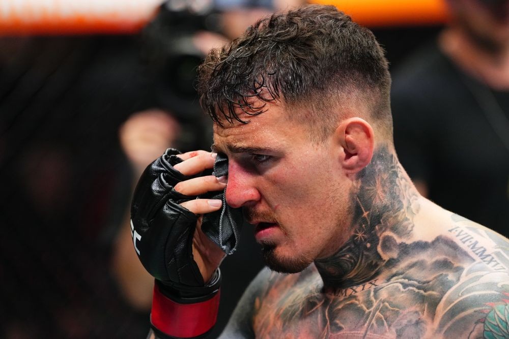 Tom Aspinall sau khi bị Ciryl Gane chọc vào mắt tại sự kiện UFC 321.