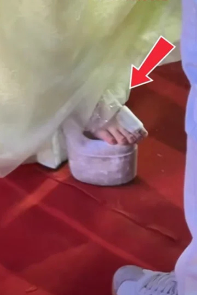 Hòa Minzy bị thương ở chân