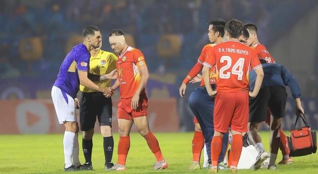 Trọng Hoàng bị Hoàng Hên vô tình giẫm rách tai.