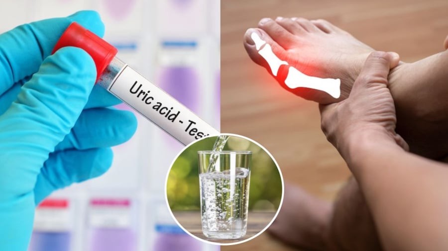 Uống nhiều nước là cách đơn giản giúp giảm axit uric trong cơ thể.