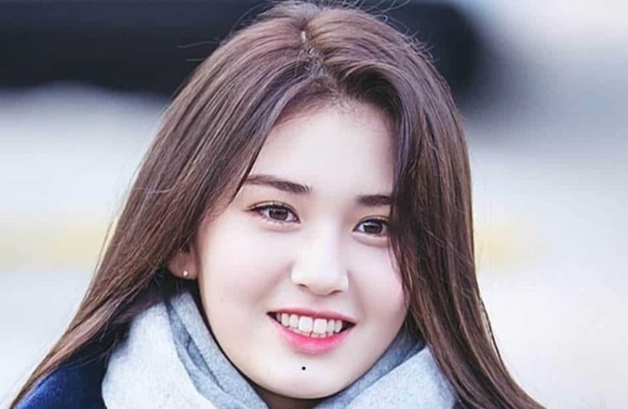 Nốt ruồi ở khu vực “địa các”, tức phần dưới cằm, được xem là nốt ruồi tài vận. Ảnh minh họa