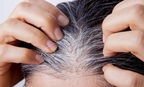 Một trong những nguyên nhân chính khiến tóc bạc sớm là thiếu vitamin nhóm B. 