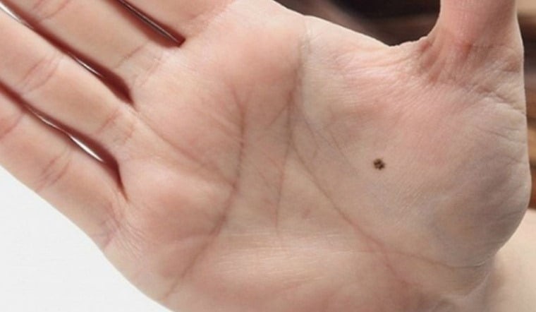 Nếu trong lòng bàn tay của Kim Ngưu xuất hiện một nốt ruồi sáng rõ, đó chính là dấu hiệu của tài lộc. Ảnh minh họa