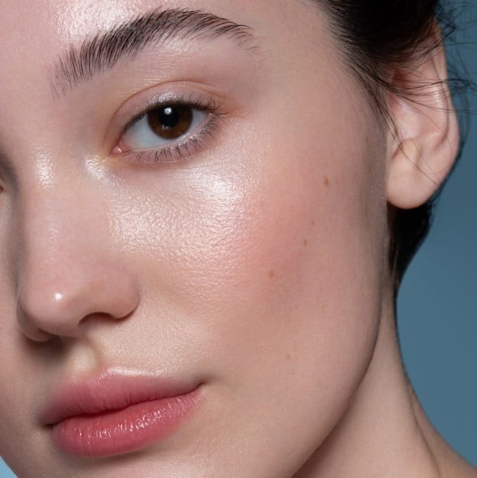 Việc bổ sung vitamin B12 quá mức có thể khiến tình trạng mụn trứng cá trở nên nghiêm trọng hơn. 