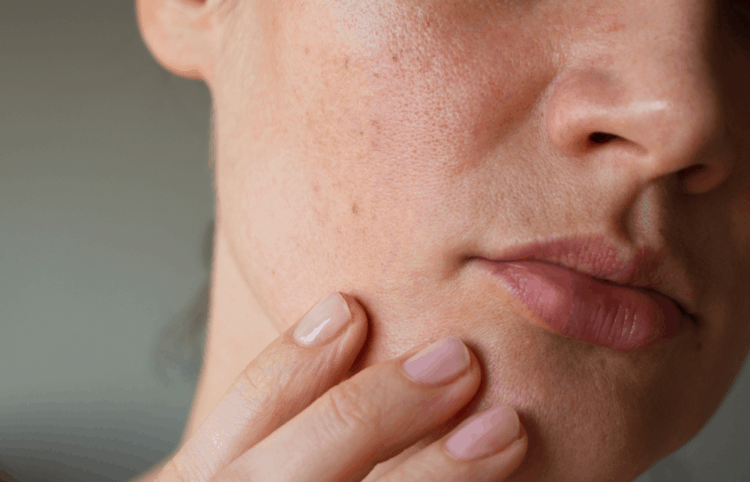 Hiện tượng mất nước qua biểu bì là yếu tố đầu tiên