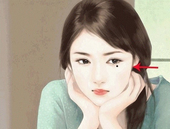 Nốt ruồi kém may mắn