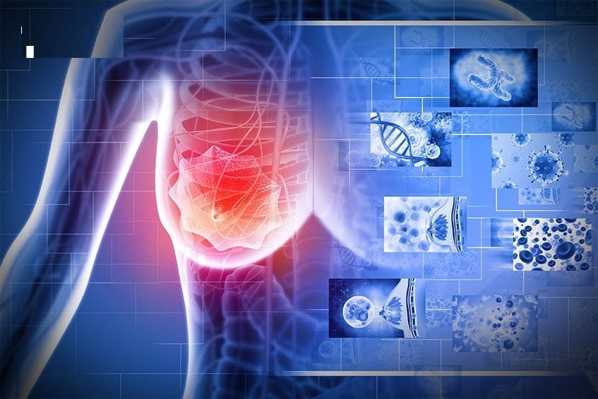 Thông thường, nốt ruồi lành tính sẽ có màu nâu ổn định, kích thước và hình dạng không đổi theo thời gian.