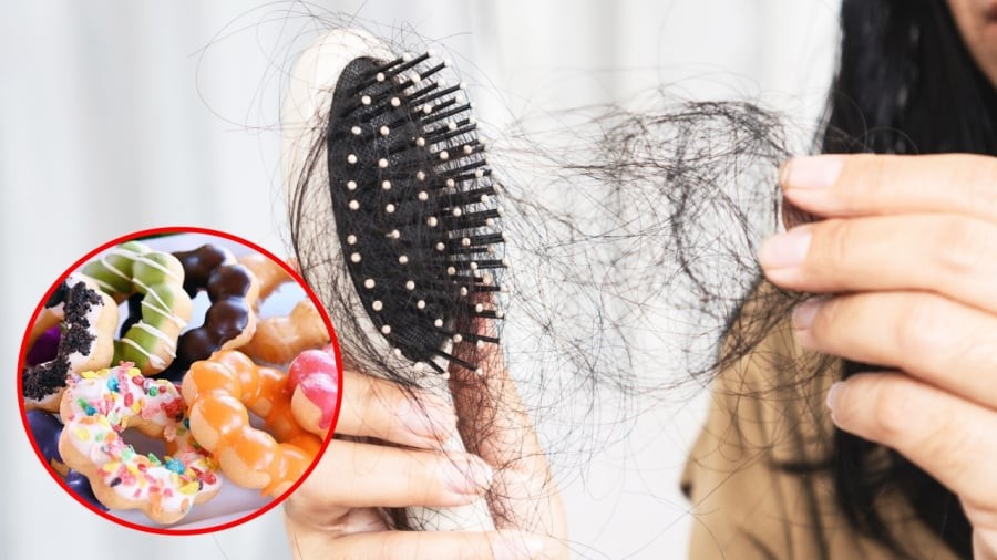 Ăn nhiều đồ ngọt có thể gây rụng tóc.
