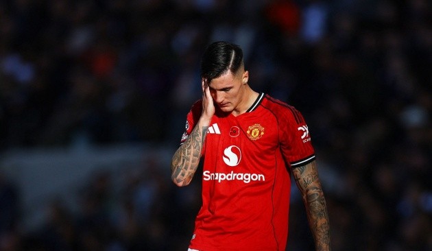 Sesko phải ngồi ngoài vì chấn thương. 