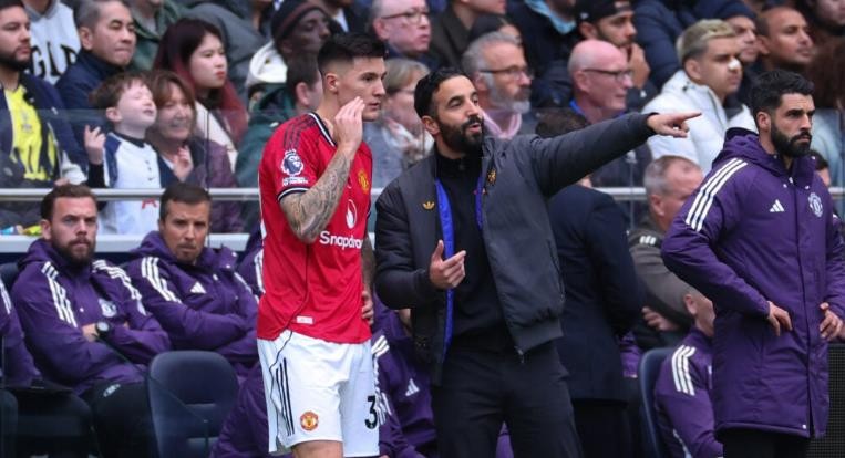 Amorim phải đau đầu khi Sesko chấn thương.