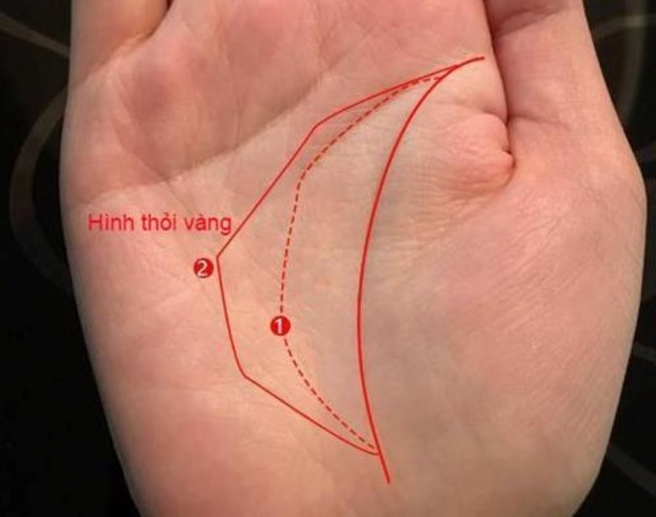 Nhận biết lòng bàn tay có hình thỏi vàng