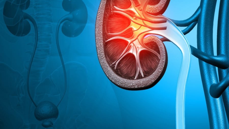 5 dấu hiệu sớm cảnh báo suy thận giai đoạn đầu: Đừng chủ quan kẻo cả đời chạy thận