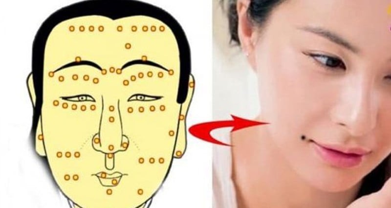 Những nốt ruồi cản trở tài lộc nên hóa giải