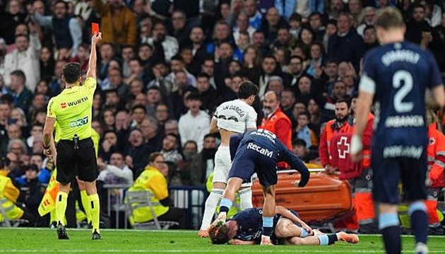 Real Madrid bị đuổi 2 người ở trận đấu với Celta Vigo.