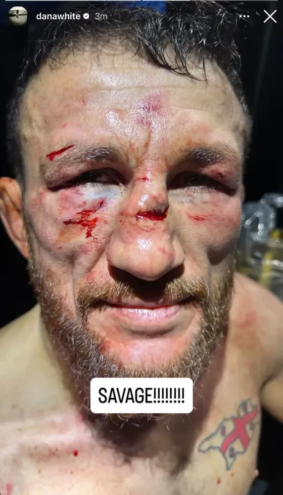 Dana White đăng ảnh Merab Dvalishvili sau trận đấu