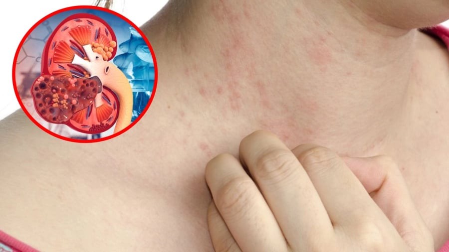 Suy thận có thể diễn ra âm thầm nhưng cũng có những dấu hiệu báo trước.