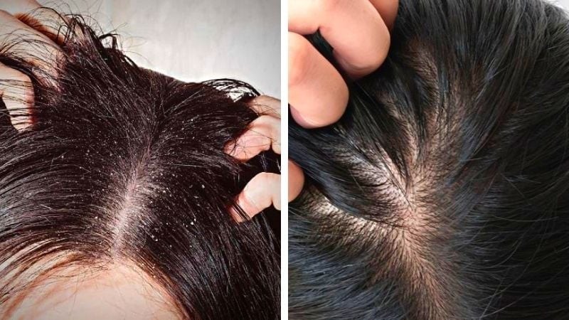 Cách làm này được sử dụng phổ biến trong các nghiên cứu nhằm đảm bảo hiệu quả và an toàn.