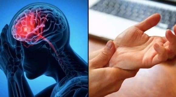 Các bác sĩ nhấn mạnh, những người có tiền sử tăng huyết áp, rối loạn mỡ máu, tiểu đường và xuất hiện các dấu hiệu trên cần đặc biệt cảnh giác, vì nguy cơ đột quỵ cao hơn.