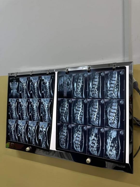 Minh Tú mắc nhiều  căn bệnh nghiêm trọng, tiết lộ chưa thể làm mẹ vì lý do này