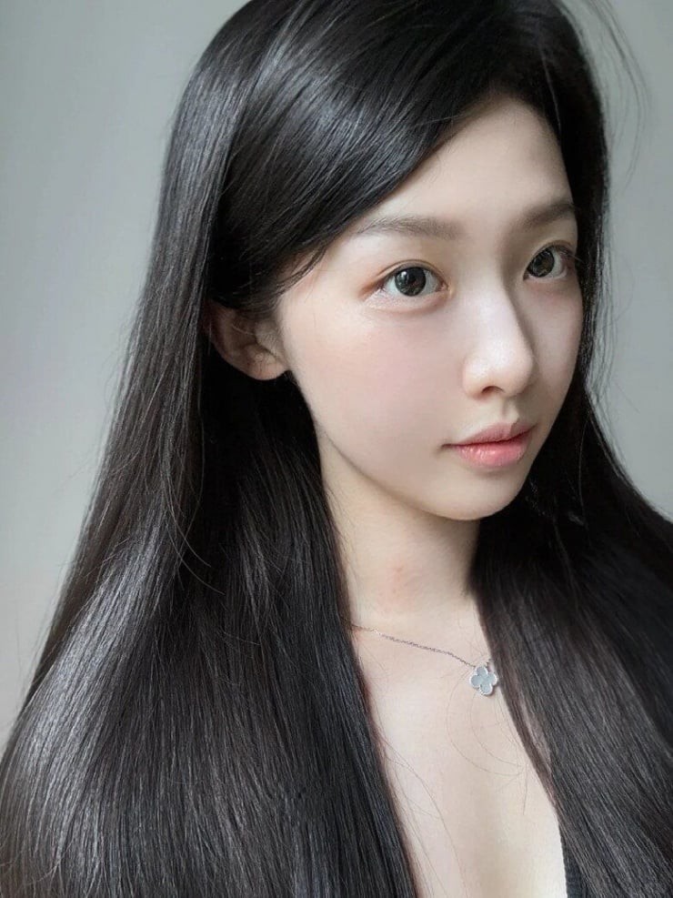 Khi tình trạng viêm kéo dài, nang tóc trở nên suy yếu, quá trình hình thành sợi tóc mới bị gián đoạn.