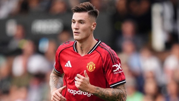 Sesko cũng phải nhanh chóng tỏa sáng.