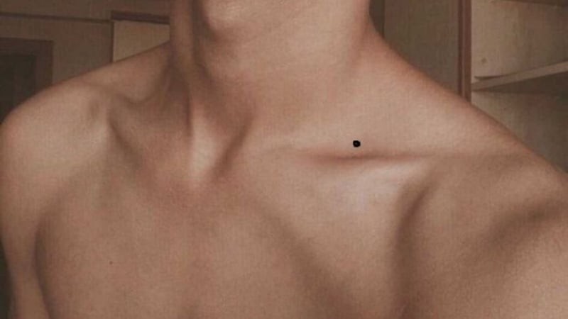 Nốt ruồi cản trở tình cảm cho phụ nữ nên hóa giải