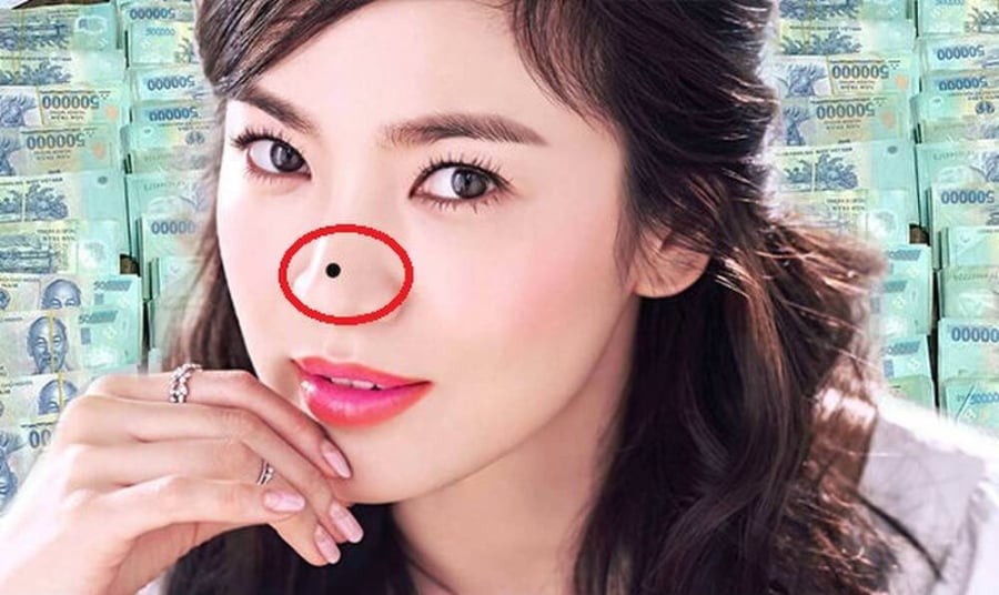 Nốt ruồi gây cản trở tài lộc lận đận tình duyên