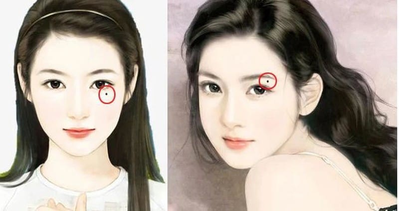 Nốt ruồi cản trở tài lộc trên mặt