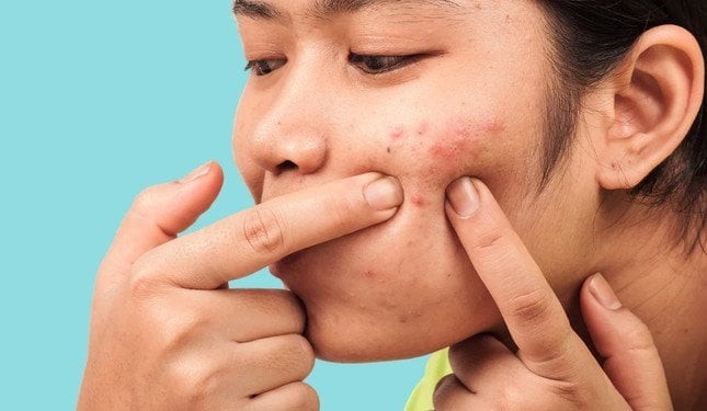 Khi tiếp xúc trực tiếp với tia UV, da có xu hướng tăng tiết dầu để tự bảo vệ, dẫn đến bít tắc lỗ chân lông.