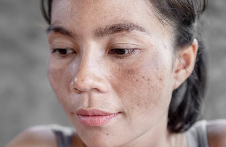 Các sản phẩm serum dưỡng sáng với hoạt chất chống oxy hóa có thể hỗ trợ làm đều màu da và cải thiện tình trạng xỉn màu nếu được sử dụng đều đặn. 