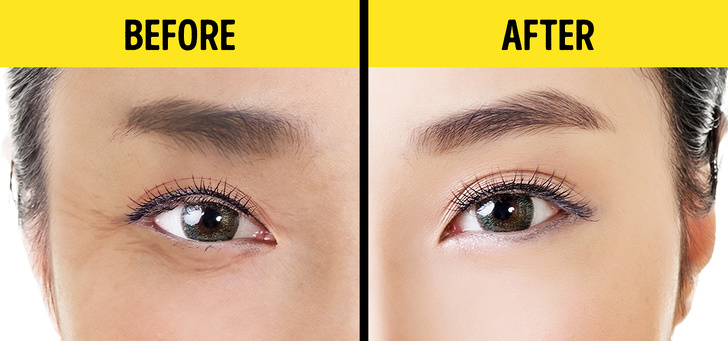  Kỹ thuật Shiatsu giúp, chống lão hóa, trẻ hóa mắt