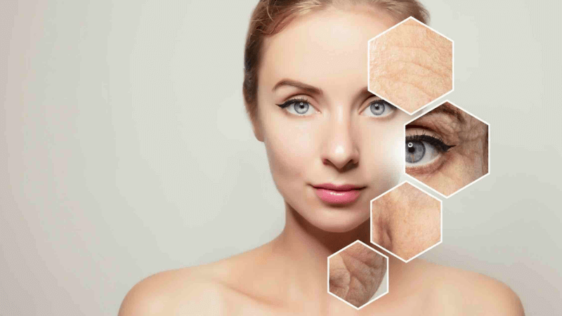 Khi tiếp xúc nắng kéo dài, các tế bào sắc tố hoạt động quá mức, sản sinh melanin không đồng đều, tạo nên những mảng sẫm màu trên da.