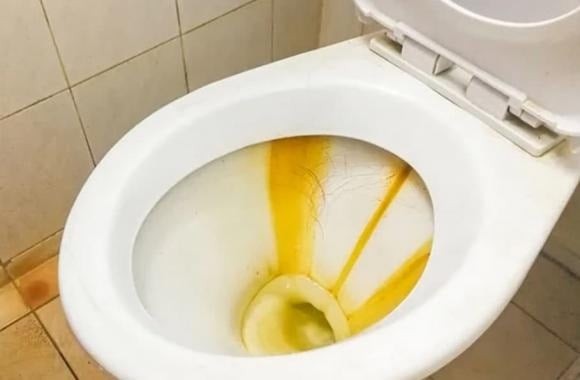 Nhờ đặc tính làm sạch và khử khuẩn, muối rất hữu ích trong việc giặt khăn bông, quần áo trắng bị ố vàng hoặc quần jean cần giữ màu.