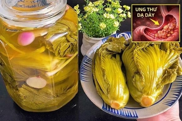 Theo các chuyên gia, việc tiêu thụ dưa muối với tần suất cao và kéo dài là yếu tố nguy cơ đáng lưu ý đối với các bệnh đường tiêu hóa, đặc biệt là ung thư dạ dày.