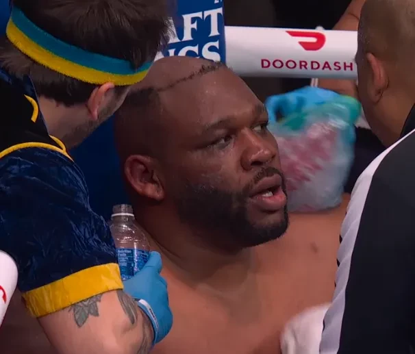 Jarrell Miller sau khi tháo tóc giả