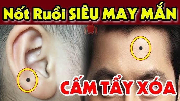 Trong đời sống thực tế, người có nốt ruồi giữa trán thường nhanh nhạy, có tầm nhìn xa, dễ nhìn thấy cơ hội mà người khác bỏ lỡ. Họ học nhanh, hiểu sâu, có tố chất lãnh đạo tự nhiên và dễ tạo được uy tín trong tập thể. Con đường sự nghiệp rộng mở, dễ đạt vị trí cao, đặc biệt hay được quý nhân lớn tuổi hoặc người có địa vị nâng đỡ.