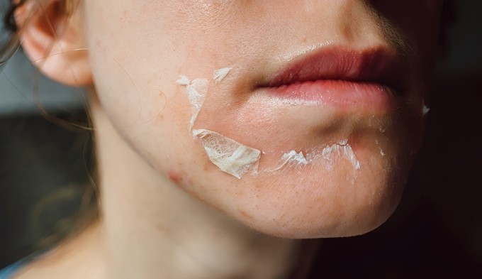  Trong giai đoạn cận Tết, việc giảm tần suất hoặc ưu tiên phương pháp làm sạch dịu nhẹ sẽ giúp da giữ được trạng thái cân bằng, hạn chế tình trạng xấu phát sinh ngoài ý muốn.