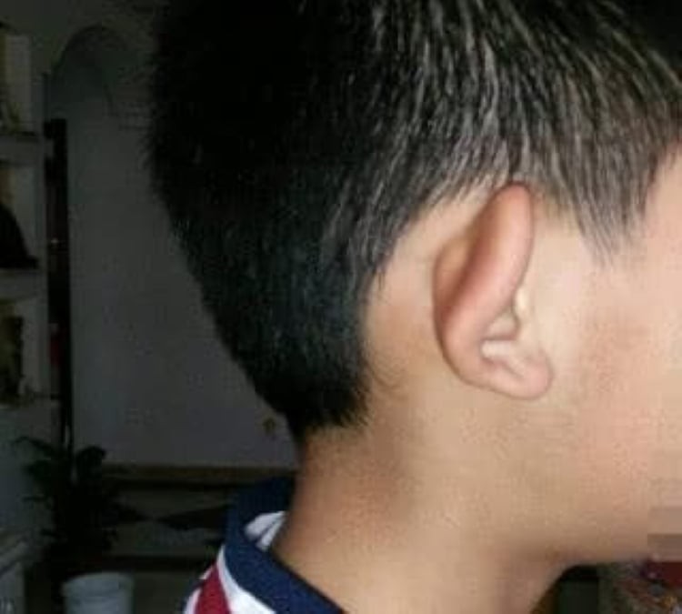 Tai thu hút gió. (Ảnh minh họa)