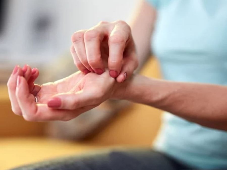 Ngứa lòng bàn tay. (Ảnh minh họa) 