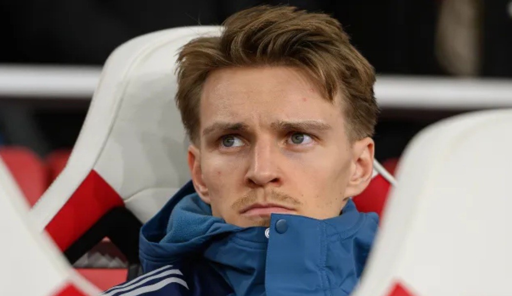 Arsenal đang không có đội hình mạnh mẽ nhất.