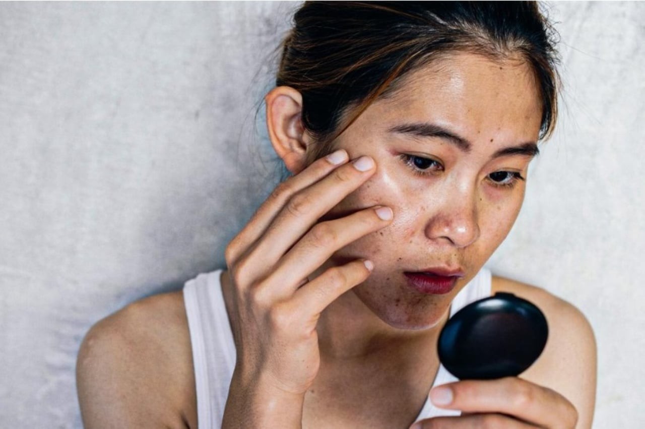 Y học cổ truyền cho rằng: 