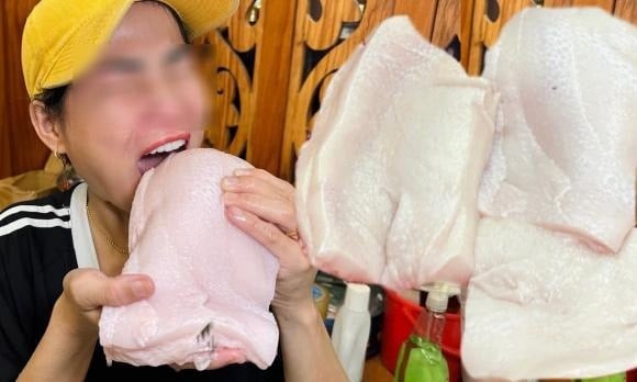 Các bác sĩ cho biết không ít bệnh nhân ung thư từng trải qua giai đoạn tăng cân nhanh, đặc biệt là vòng eo ngày càng lớn trước khi được chẩn đoán bệnh. 