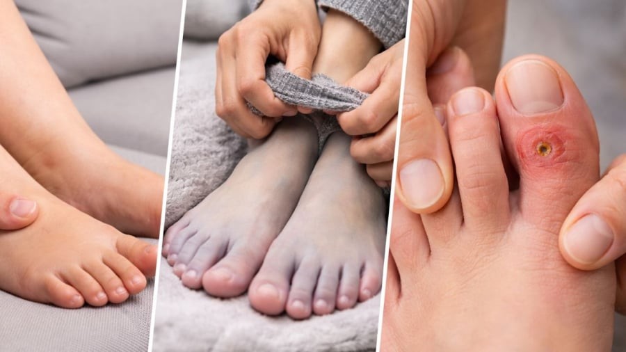Khi chân cùng lúc xuất hiện các dấu hiệu này thì bạn nên chú ý
