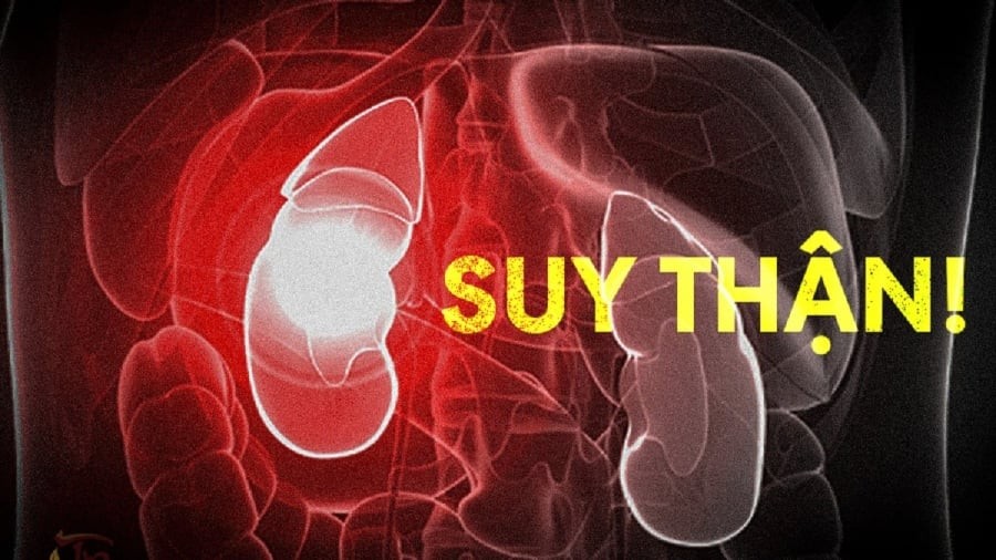 5 dấu hiệu vào ban đêm cảnh báo suy thận giai đoạn muộn