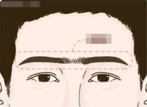 “Chân mày giao” hay lông mày nối liền là tình trạng hai đầu chân mày gần nhau hoặc liền thành một đường trên gương mặt.